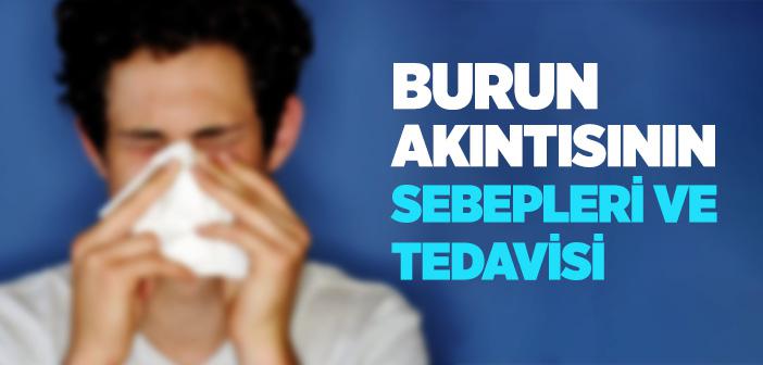 Burun Akıntısının Nedenleri ve Tedavisi