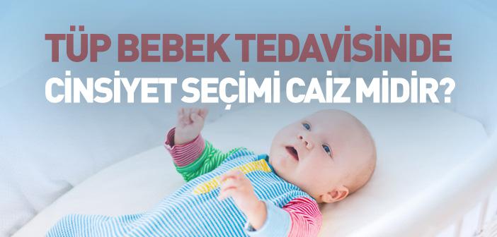 Tüp Bebek Tedavisinde Cinsiyet Seçimi Caiz midir?