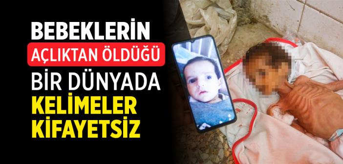 İsrail Ablukası Altındaki Gazze'de 3 Aylık Bebek Curi De Açlıktan Hayatını Kaybetti