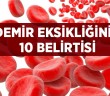 Kadınlarda Sık Görülen Hastalık