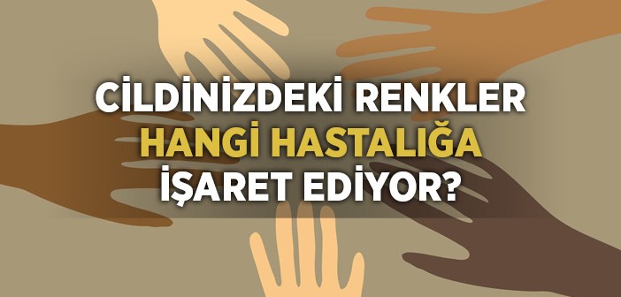 Bunlar Cilt Hastalıklarının Habercisi