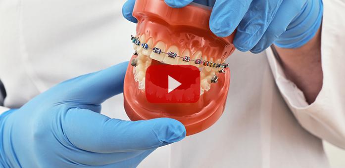 Diş Telinin Temizliği Nasıl Yapılır?