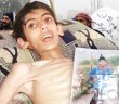 Suriye’de İnsanlar Açlıktan Ölüyor