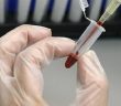 Düşük Riskini Tespit Edecek Test