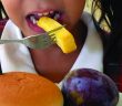 Çocukluk Çağı Obezitesi Artıyor