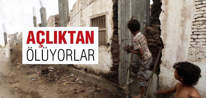 Yemen'de Açlıktan Ölüyorlar