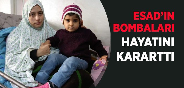 Esad'ın Bombaları Hayatını Kararttı