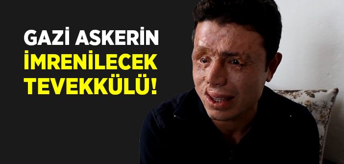 Gazi Askerin İmrenilecek Tevekkülü