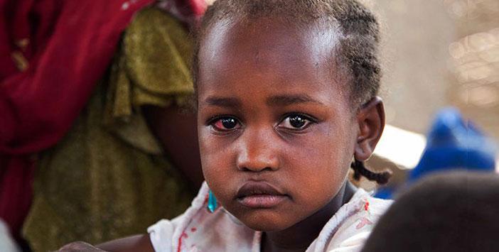 Sudan'da Binlerce Çocuk Yetim Kaldı
