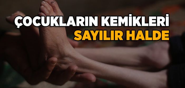 Çocukların Kemikleri Sayılır Halde