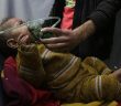 Doğu Guta'da İnsanlık Suçu Kimyasal Silah Kullanıldı