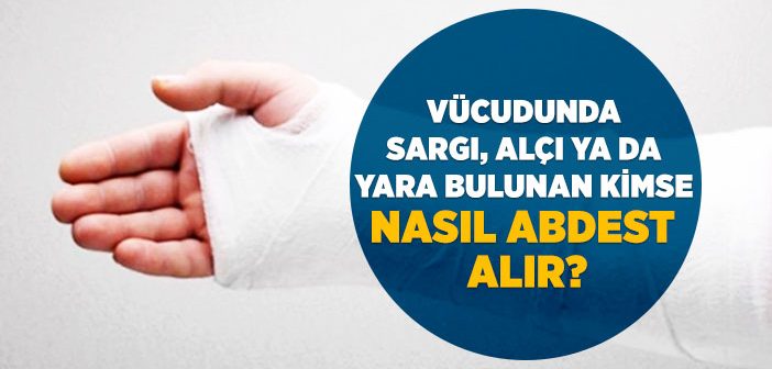 Vücudunda Sargı, Alçı Ya Da Yara Bulunan Kimse Nasıl Abdest Alır?