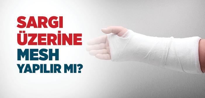 Sargı Üzerine Mesh Nasıl Yapılır?