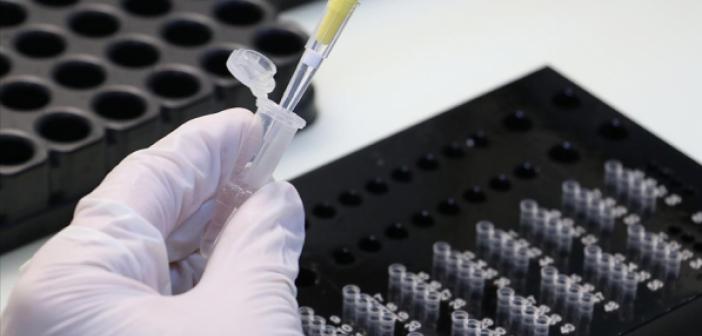 Kovid-19 Aşısı Olmayan İşçilerden Haftada Bir Kez PCR Testi Yaptırmaları İstenebilecek