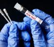 PCR Testi Zorunluluğu Kaldırıldı