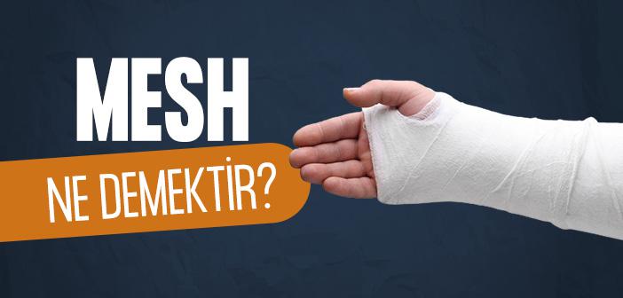 Mesh Nedir?