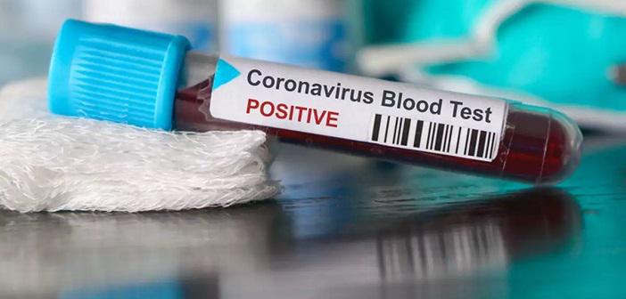 Koronavirüs Hastası Evde Nelere Dikkat Etmelidir?