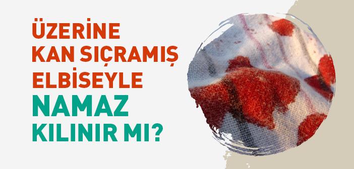 Üzerine Kan Sıçramış Elbiseyle Namaz Kılmak Caiz mi?