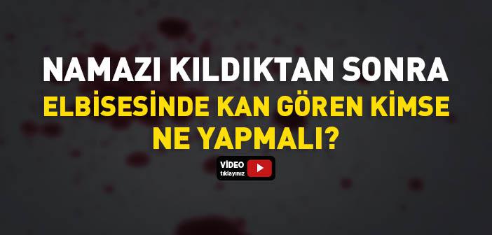 Namazı Kıldıktan Sonra Elbisesinde Kan Gören Kimse Ne Yapmalı?