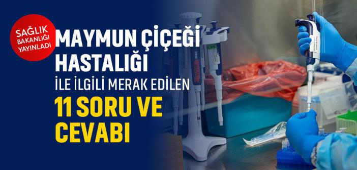 Sağlık Bakanlığı, "M Çiçeği" Hastalığına İlişkin Merak Edilen 11 Soruyu İnternetten Yanıtladı